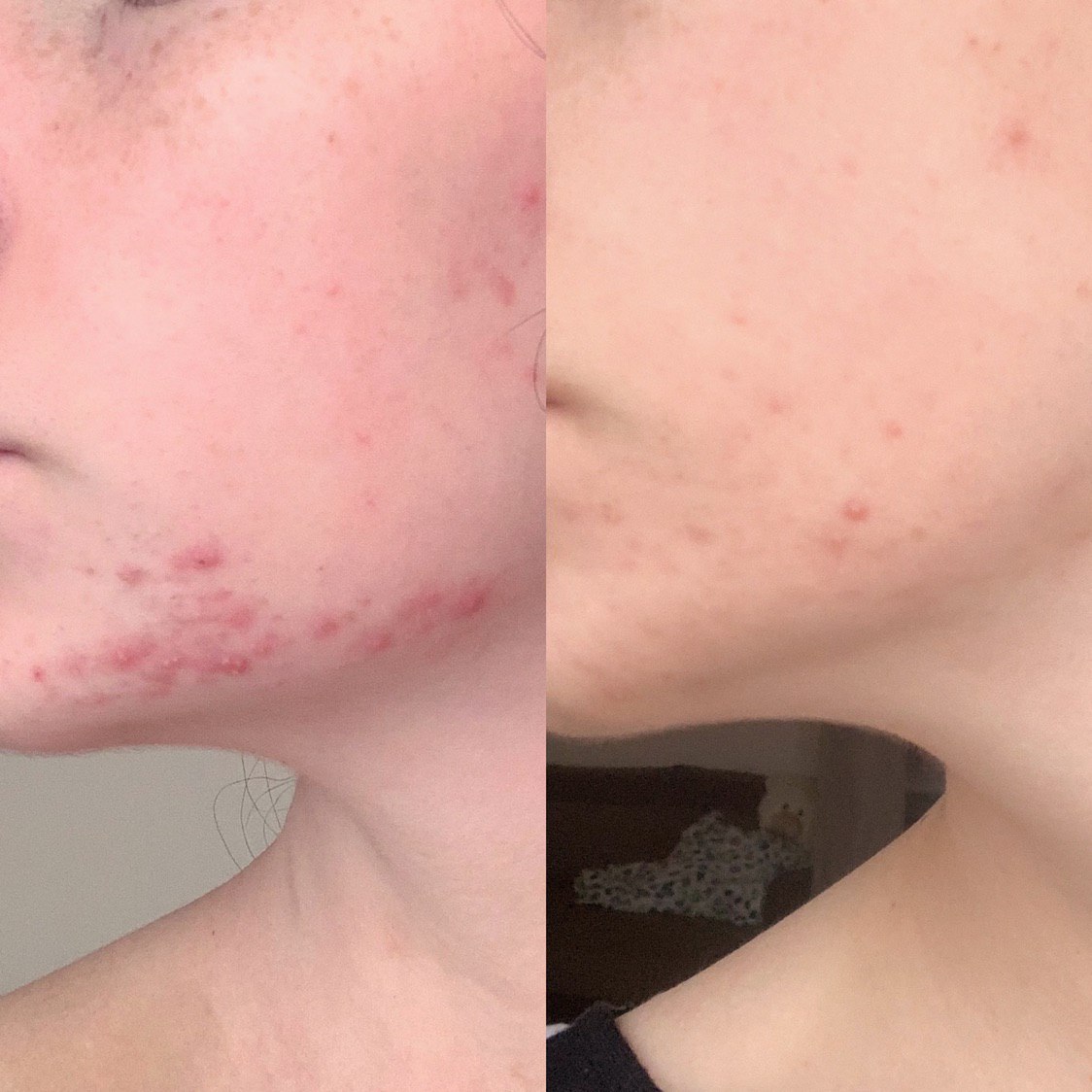 Как Pixi Glycolic Tonic повлиял на состояние кожи после поездки в Китай?