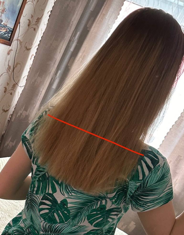 Стоит ли мне стричь волосы, если они сильно выпадают и как это повлияет на внешний вид?